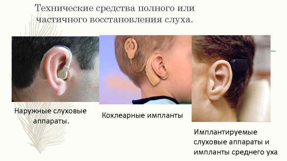 Нарушения слуховых функций