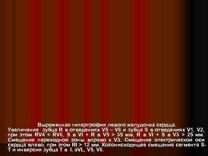 Выраженная гипертрофия левого желудочка сердца. Увеличение зубца R в отведениях V 5 – V