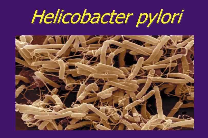 Helicobacter pylori 