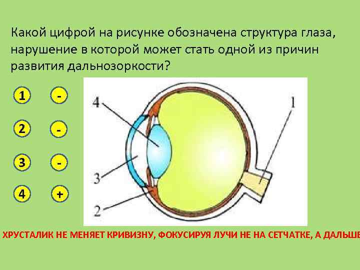 Какой цифрой на рисунке обозначена структура глаза, нарушение в которой может стать одной из