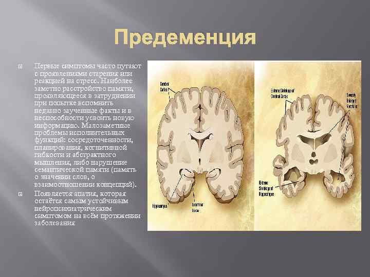 Предеменция Первые симптомы часто путают с проявлениями старения или реакцией на стресс. Наиболее заметно