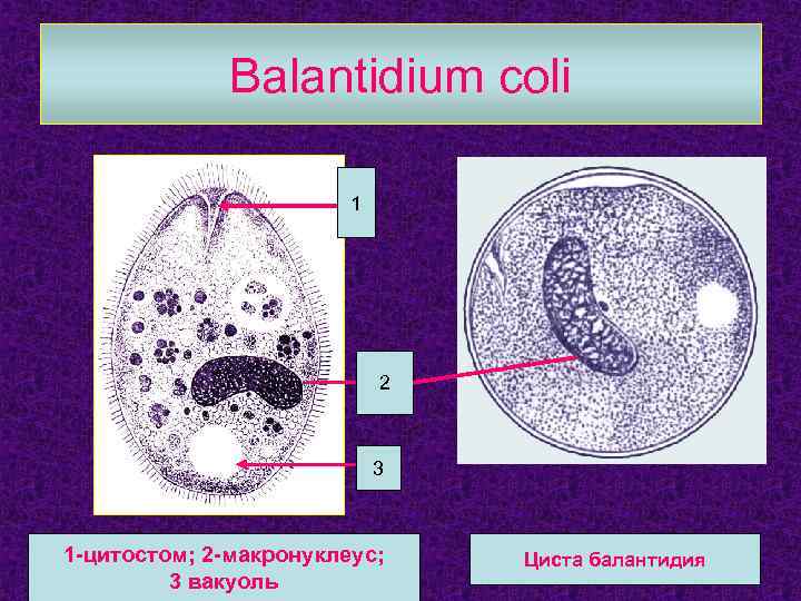 Balantidium coli 1 2 3 1 -цитостом; 2 -макронуклеус; 3 вакуоль Циста балантидия 