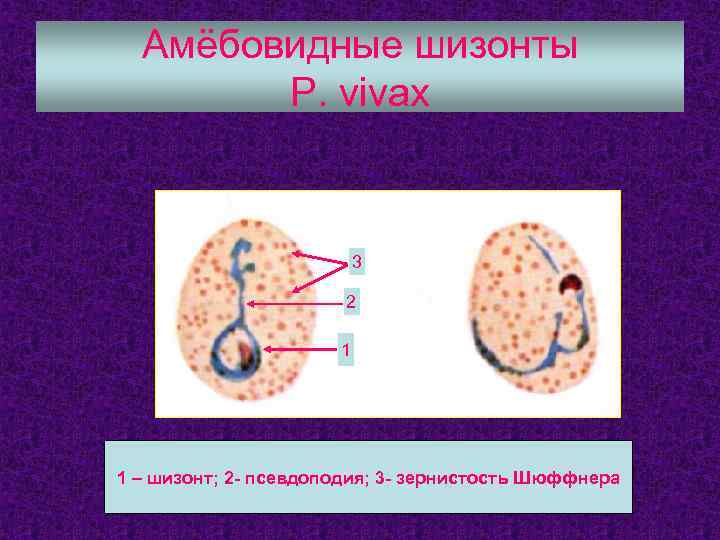 Амёбовидные шизонты P. vivax 3 2 1 1 – шизонт; 2 - псевдоподия; 3