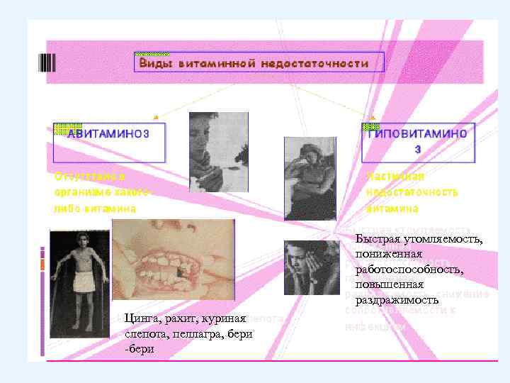 Быстрая утомляемость, пониженная работоспособность, повышенная раздражимость Цинга, рахит, куриная слепота, пеллагра, бери -бери 