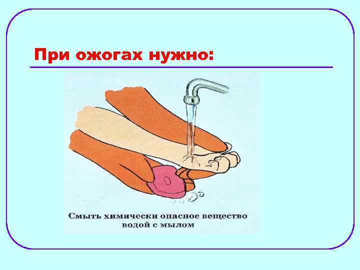 При ожогах нужно: 