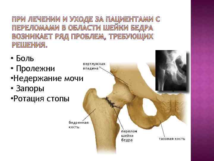  • Боль • Пролежни • Недержание мочи • Запоры • Ротация стопы 