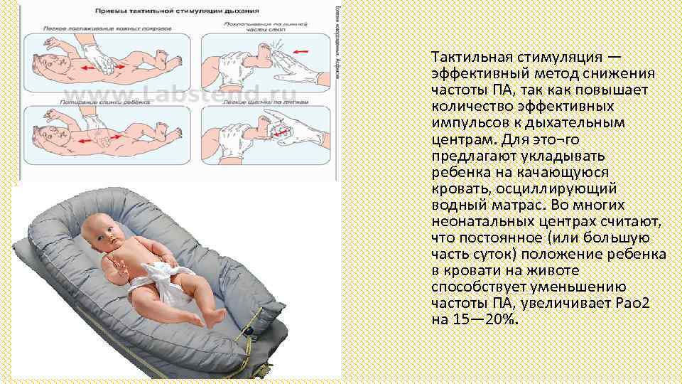 Тактильная стимуляция — эффективный метод снижения частоты ПА, так как повышает количество эффективных импульсов