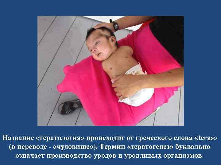 Название «тератология» происходит от греческого слова «teras» (в переводе - «чудовище» ). Термин «тератогенез»