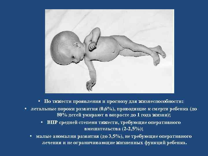  • По тяжести проявления и прогнозу для жизнеспособности: • летальные пороки развития (0,