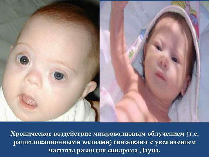 Хроническое воздействие микроволновым облучением (т. е. радиолокационными волнами) связывают с увеличением частоты развития синдрома