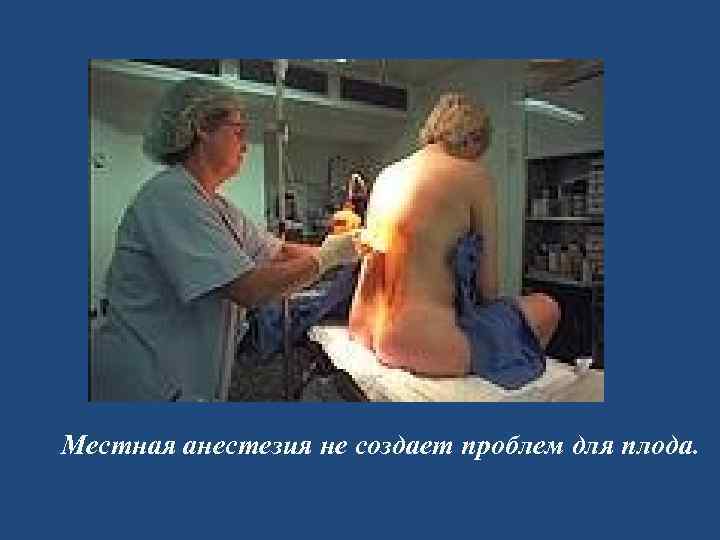 Местная анестезия не создает проблем для плода. 