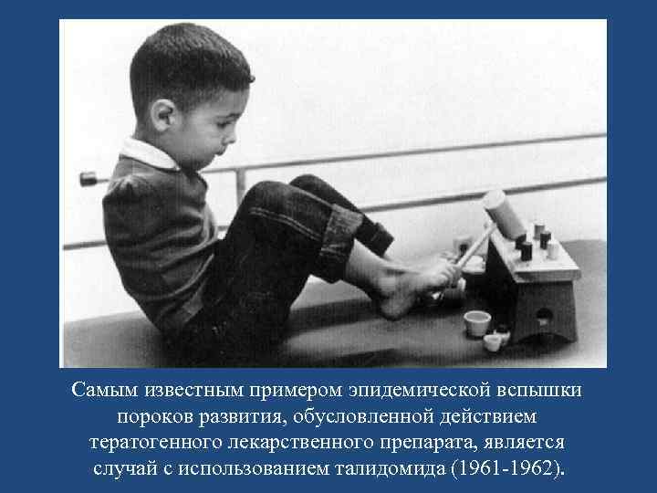 Самым известным примером эпидемической вспышки пороков развития, обусловленной действием тератогенного лекарственного препарата, является случай