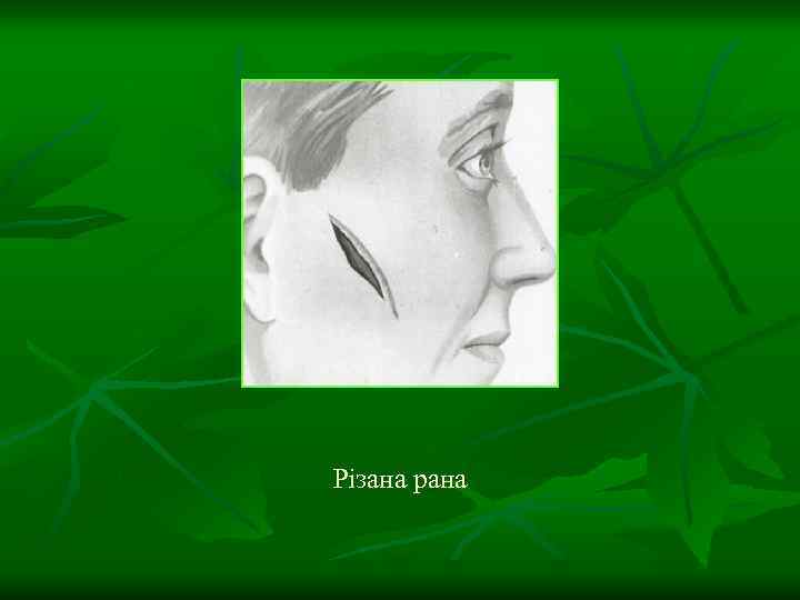 Різана рана 