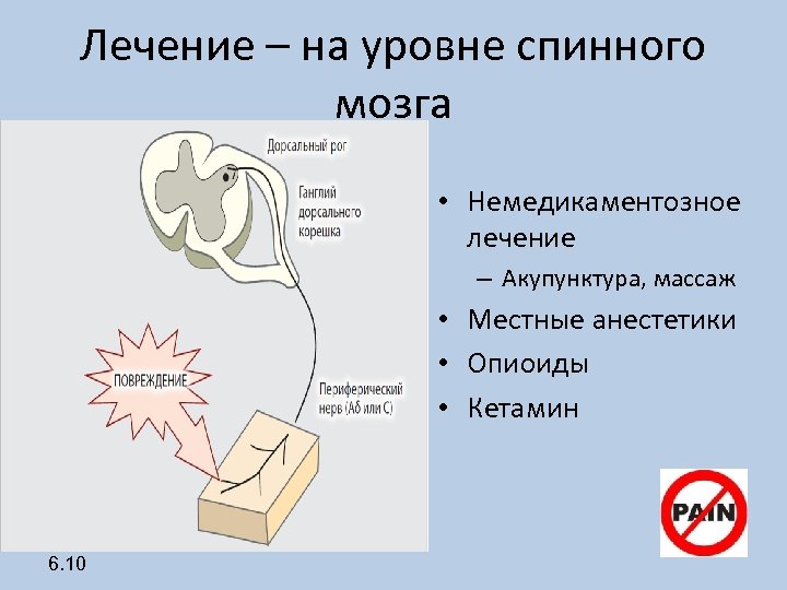 Лечение – на уровне спинного мозга • Немедикаментозное лечение – Акупунктура, массаж • Местные