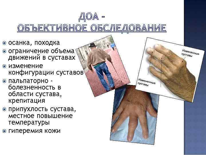 осанка, походка ограничение объема движений в суставах изменение конфигурации суставов пальпаторно болезненность в области