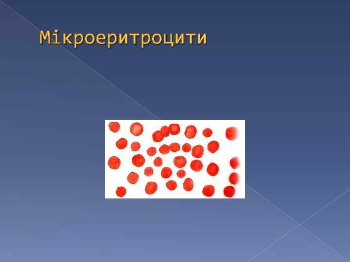 Мікроеритроцити 