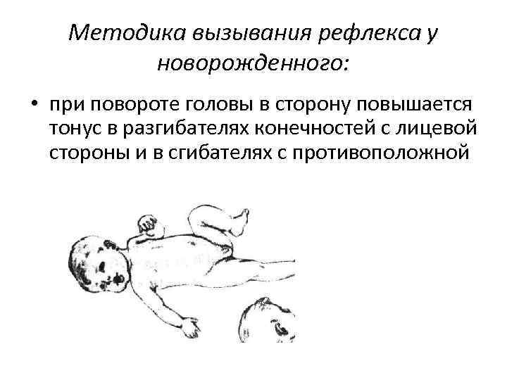 Методика вызывания рефлекса у новорожденного: • при повороте головы в сторону повышается тонус в