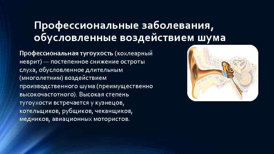 Шум профессиональные заболевания