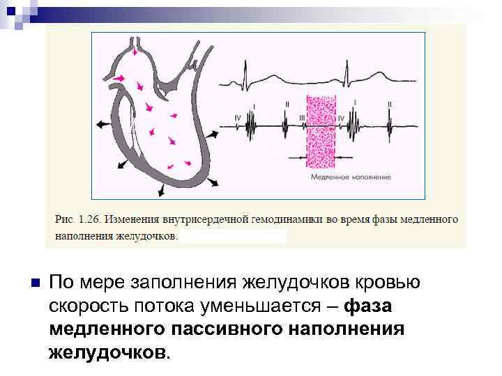 n По мере заполнения желудочков кровью скорость потока уменьшается – фаза медленного пассивного наполнения