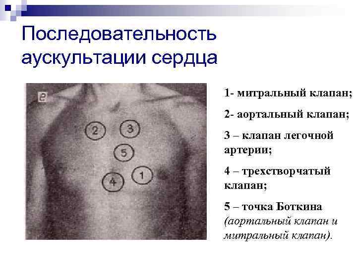 Последовательность аускультации сердца 1 - митральный клапан; 2 - аортальный клапан; 3 – клапан