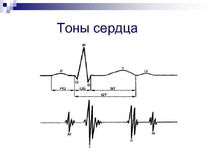 Тоны сердца 