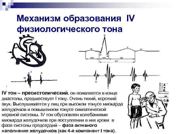 Механизм образования IV физиологического тона IV тон – пресистолический, он появляется в конце диастолы,