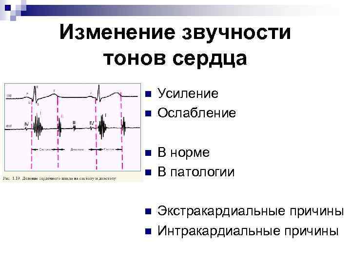 Изменение звучности тонов сердца n n n Усиление Ослабление В норме В патологии Экстракардиальные