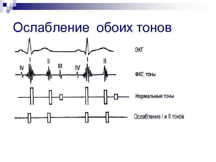 Ослабление обоих тонов 