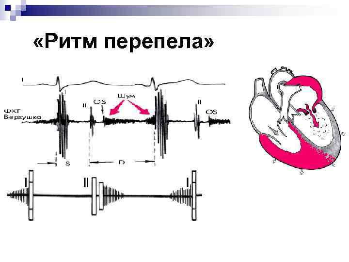  «Ритм перепела» 