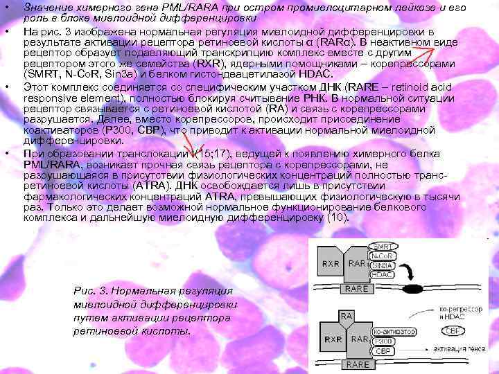  • • Значение химерного гена PML/RARA при остром промиелоцитарном лейкозе и его роль