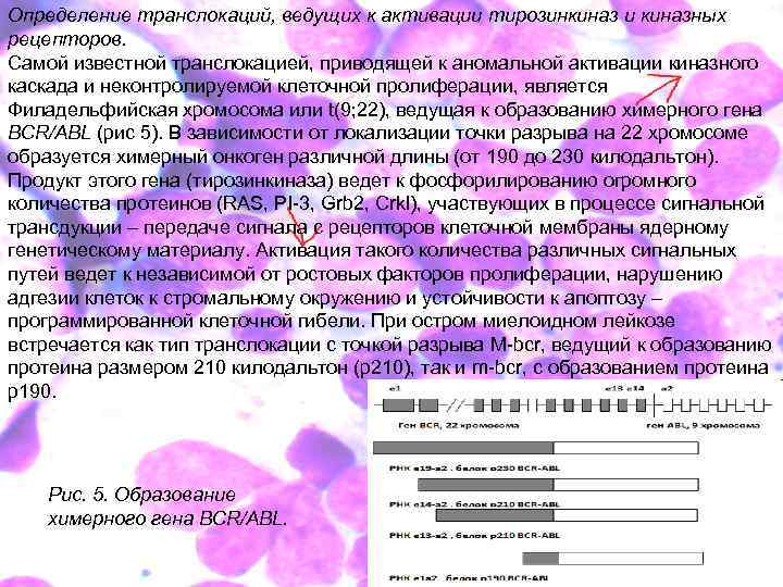 Определение транслокаций, ведущих к активации тирозинкиназ и киназных рецепторов. Самой известной транслокацией, приводящей к