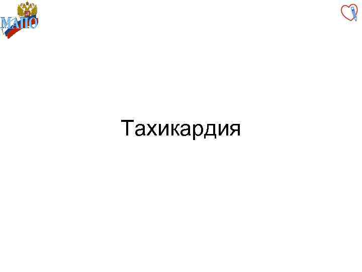 Тахикардия 