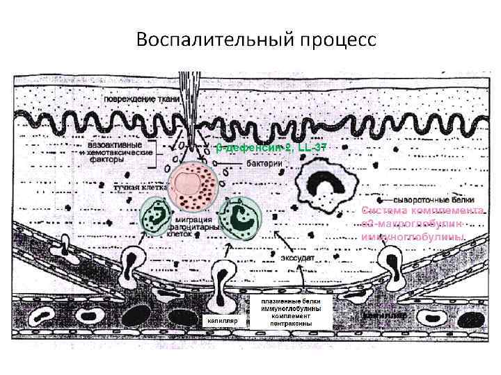 Рассмотрите схему воспалительного процесса