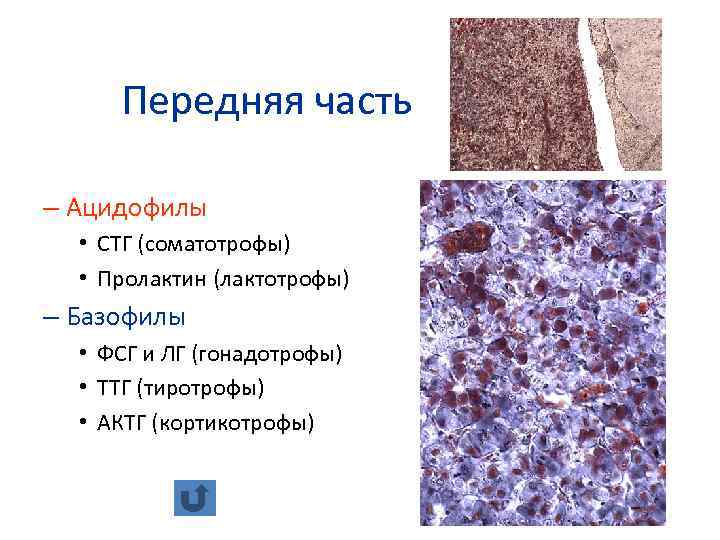 Передняя часть – Ацидофилы • СТГ (соматотрофы) • Пролактин (лактотрофы) – Базофилы • ФСГ