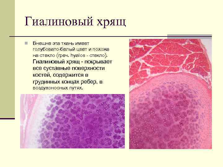 Гиалиновый хрящ n Внешне эта ткань имеет голубовато-белый цвет и похожа на стекло (греч.