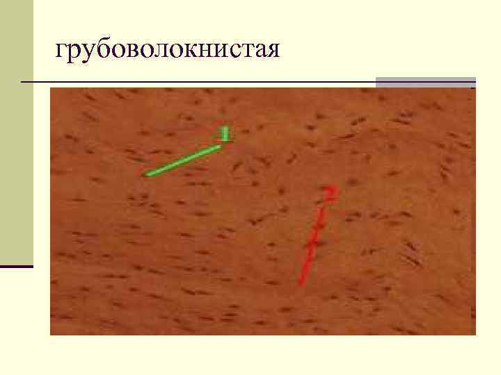 грубоволокнистая 