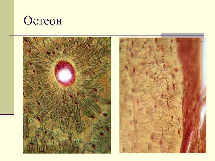 Остеон 