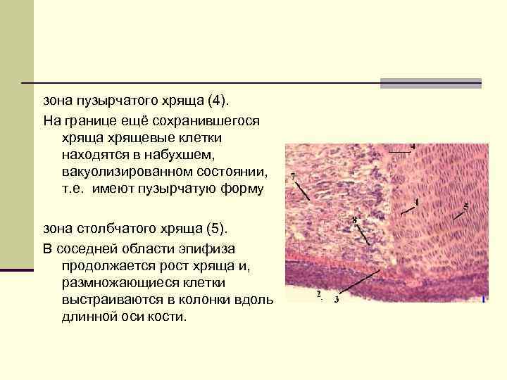 зона пузырчатого хряща (4). На границе ещё сохранившегося хряща хрящевые клетки находятся в набухшем,