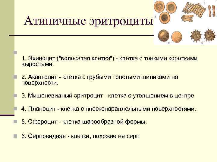 Атипичные эритроциты n 1. Эхиноцит (