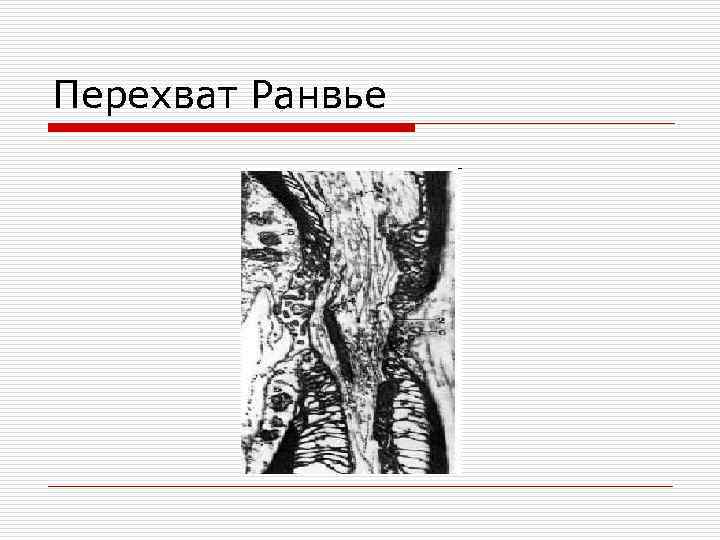 Перехват Ранвье 