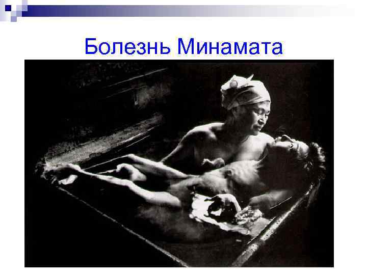 Болезнь Минамата 