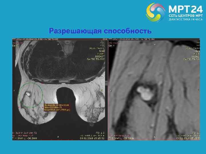Разрешающая способность 
