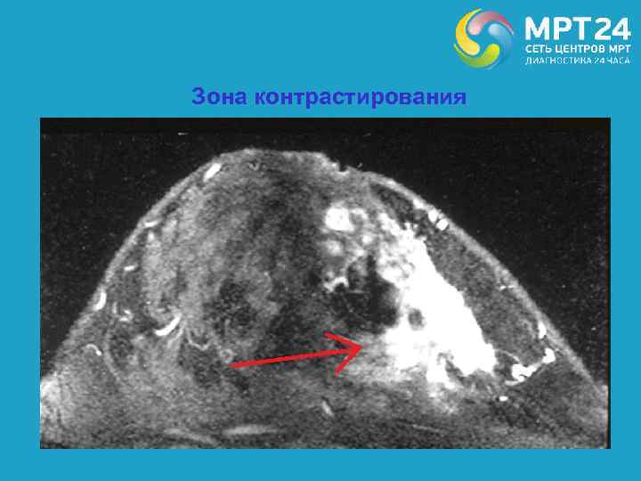 Зона контрастирования 