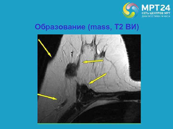 Образование (mass, T 2 ВИ) 