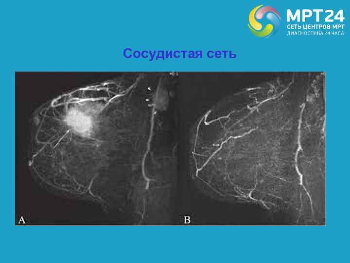 Сосудистая сеть 