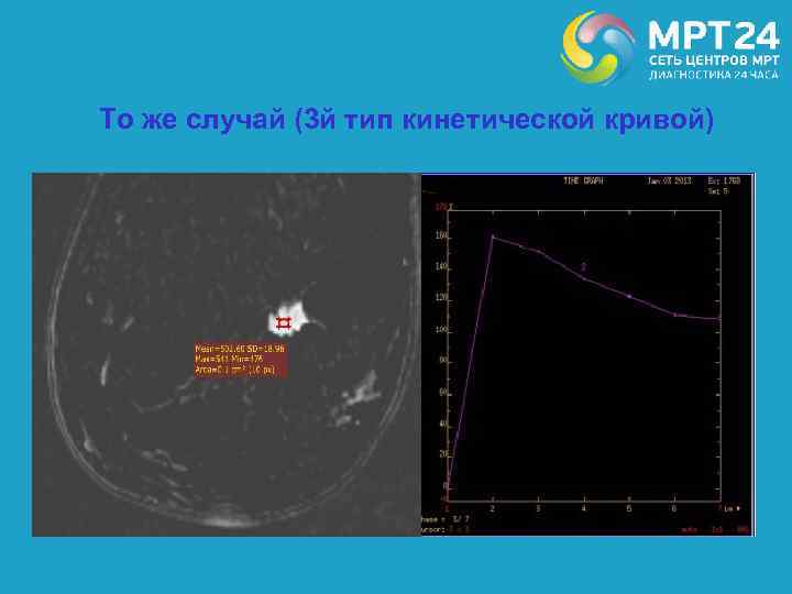 То же случай (3 й тип кинетической кривой) 