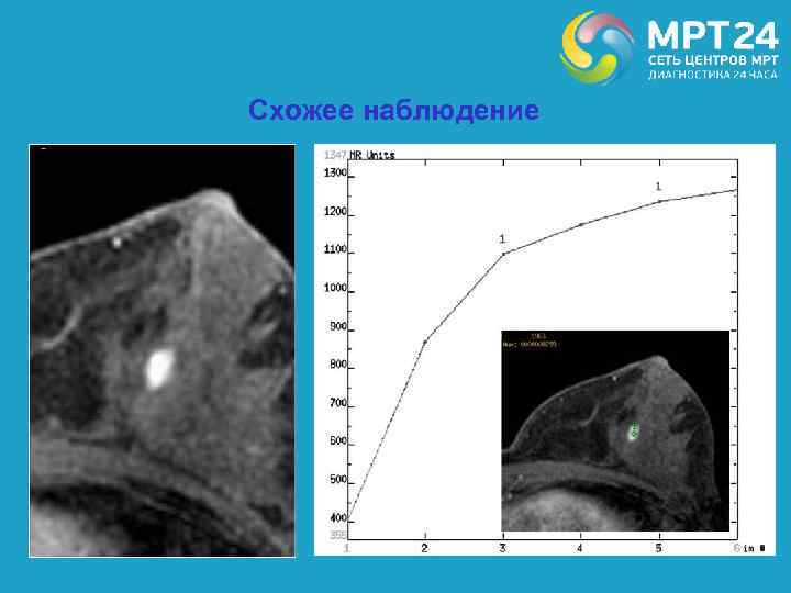 Схожее наблюдение 