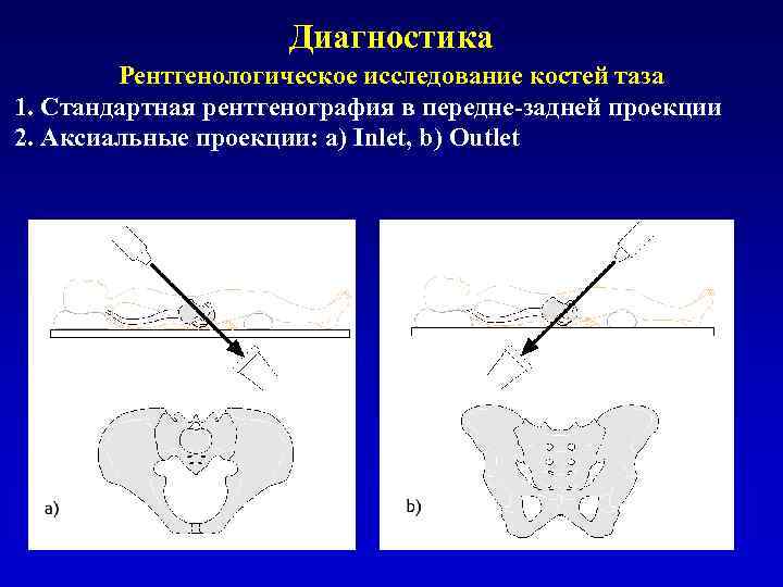 Проекция таза