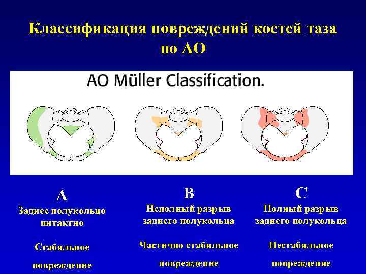 Переломы таза травматология презентация