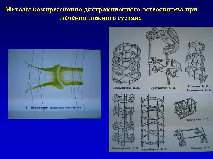 Замедленная консолидация презентация